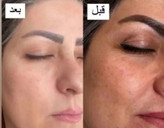 پک کرم ضد لک لاکچری کوین و صابون ضد لک استین اصل اصل
